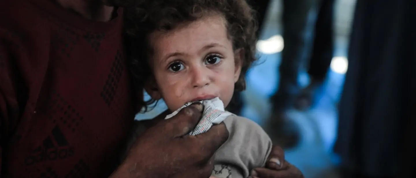 Rund 26.000 Kinder im Gazastreifen benötigen dringend eine Behandlung wegen Mangelernährung | © UNICEF/Nateel News Gaza: Rund 26.000 Kinder im Gazastreifen benötigen dringend eine Behandlung wegen Mangelernährung